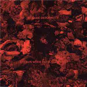 Human Deformity - Uterus With Infected Fungi