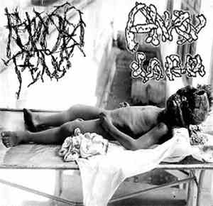 Ruptured Fetus, Anal Larva - split
