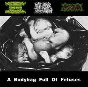 SxGxAxEx, Rectal Abscess Infection Discharge, Ingrown - A Bodybag Full Of F ...