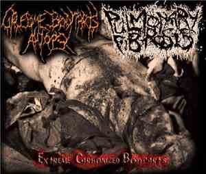 Gruesome Bodyparts Autopsy / Pulmonary Fibrosis - Extreme Carbonized Bodypa ...