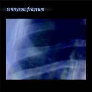 Tennyson Fracture - Tennyson Fracture