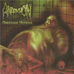 Anarkhon - Obesidade mórbida
