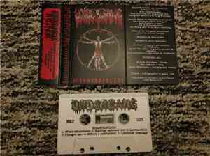 Undergang  - Misantropologi