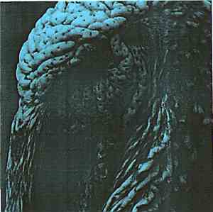 H5N1  - Response To H5N1 - Outbreak In Hong Kong