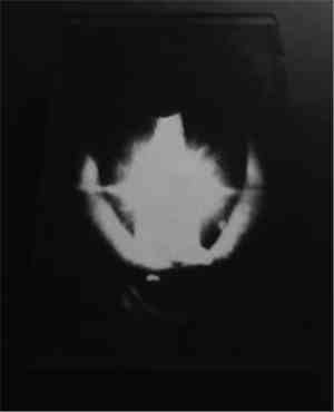 Nigrum Ignis Circuli - SkullKrush