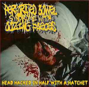 Perforated Bowel Syndrome With Oozing Faeces - Head Hacked In Half With A H ...