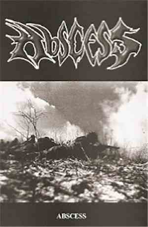 Abscess  - Abscess