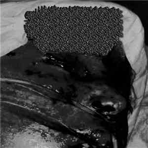 Ecthyma Gangrenosum - Demo