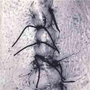 Scheer - Infliction