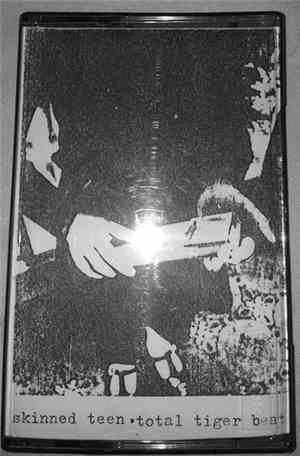 Skinned Teen - Total Tiger Beat