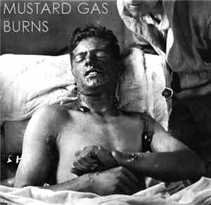 Suffocating Respirator - Mustard Gas Burns