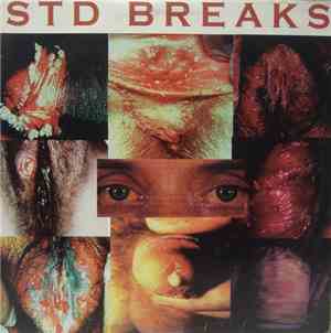 The Wax Fondler - STD Breaks