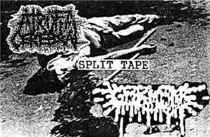 Atrofia Cerebral / Germen - Split