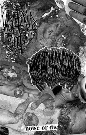 Hypoprothrombinemia, Vomiting Shit - Noise Or Die