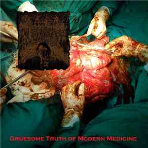MxOxPxCxBxIxTxIxLxOxTxBxVx - Gruesome Truth Of Modern Medicine