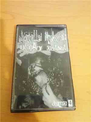 Uncontrolled Immeasurable Urinary Output - Demo 4