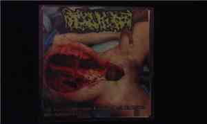 Hydrocephalus - The Perverted Forensic Examiner Left His Dick In Her Autops ...